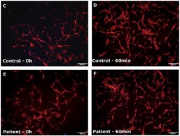 Actin re-polymerization