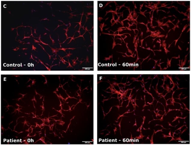 Actin re-polymerization