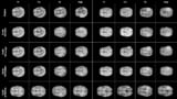 Synthetic brain MR images
