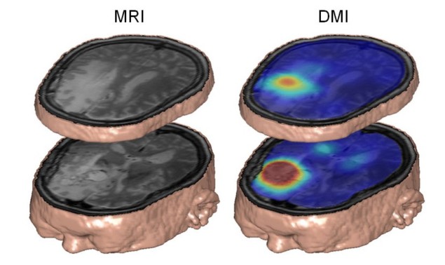 DMI