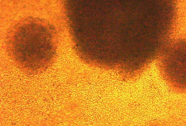 T cells T cells