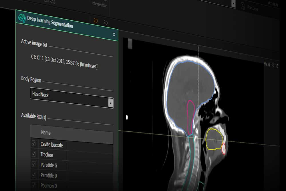 Radiation Treatment Planning Technologies