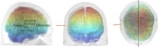 Visualizing brain atrophy