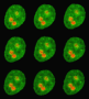 Merging nucleoli