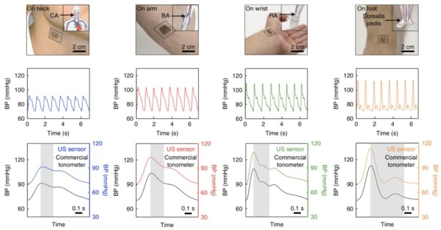 Wearable Patch Measures Central Blood Pressure – Physics World