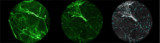 Identifying Gram-negative bacteria in the lung