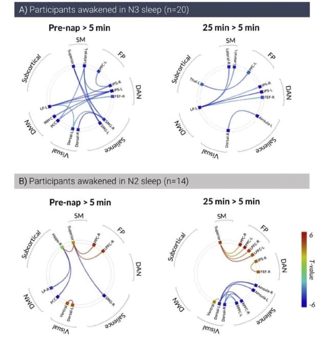 Simultaneous EEG and fMRI measure sleep 'inertia' Physics World