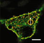 Phagocyte lipids surround polystyrene beads. Adapted from Mu et al/Nature Communications under Creative Commons Attribution 4.0