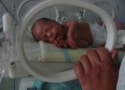 Premature infant