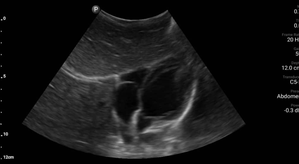 Ultrasound scan