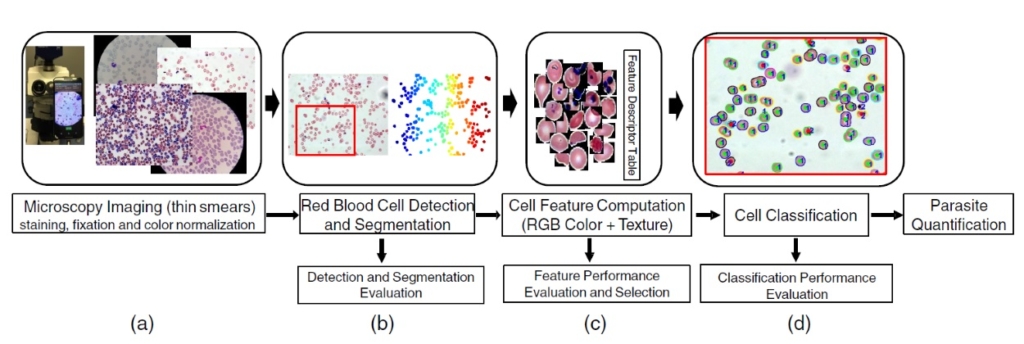 Automated system offers fast, reliable malaria screening – Physics World