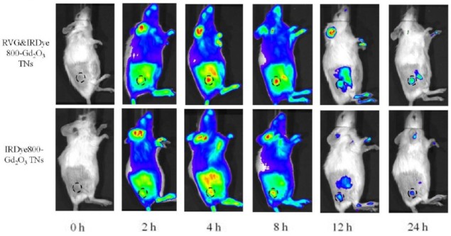 Fluorescence imaging