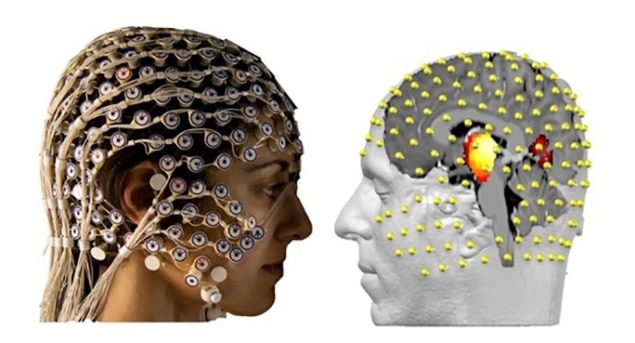 EEG records brain activity