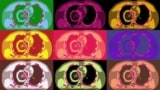 POP-ART RT