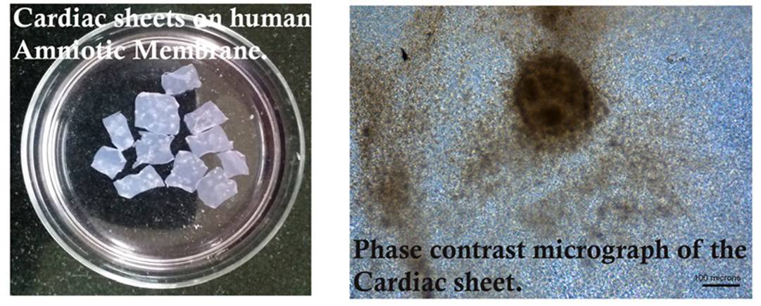 Cardiac sheets