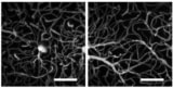 Vascular imaging