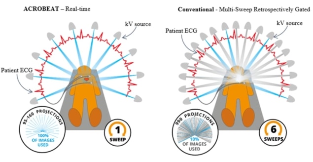 ACROBEAT versus conventional imaging