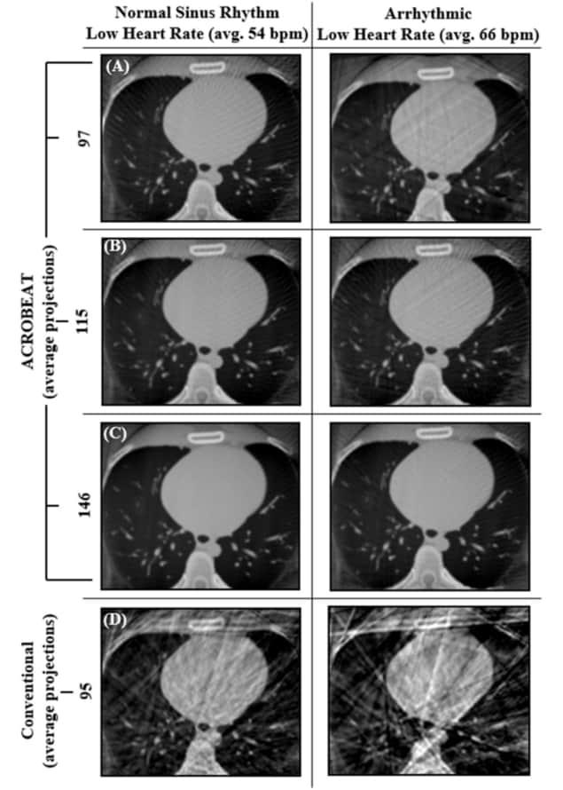 Reconstructed cardiac-gated images