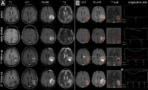 Automated processing of MRI exams