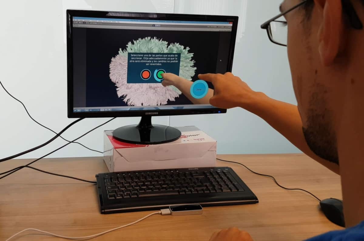 3D brain model