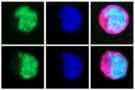 Circulating tumour cells