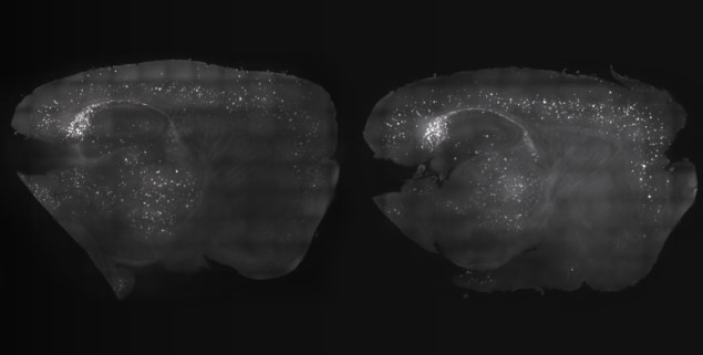 Reducing amyloid plaques