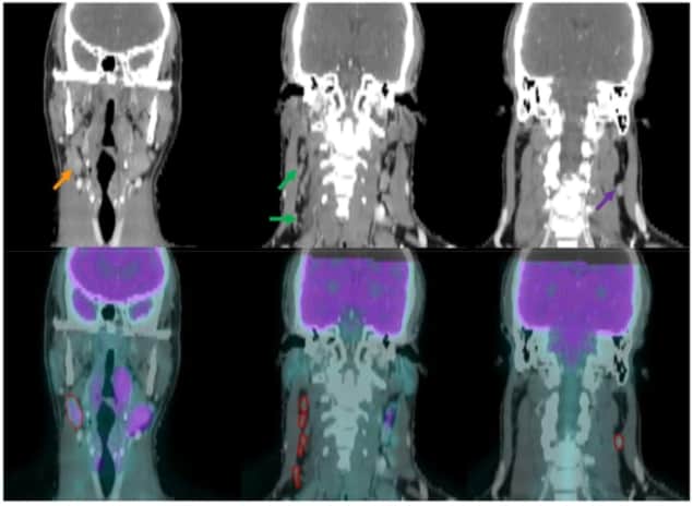 Lymph node images