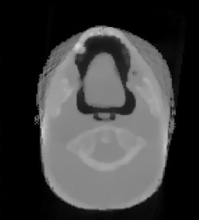 Proton CT of a head phantom