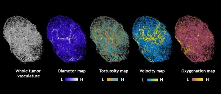 Seeing cancer in a new light: creating an atlas of blood flow in tumour ...