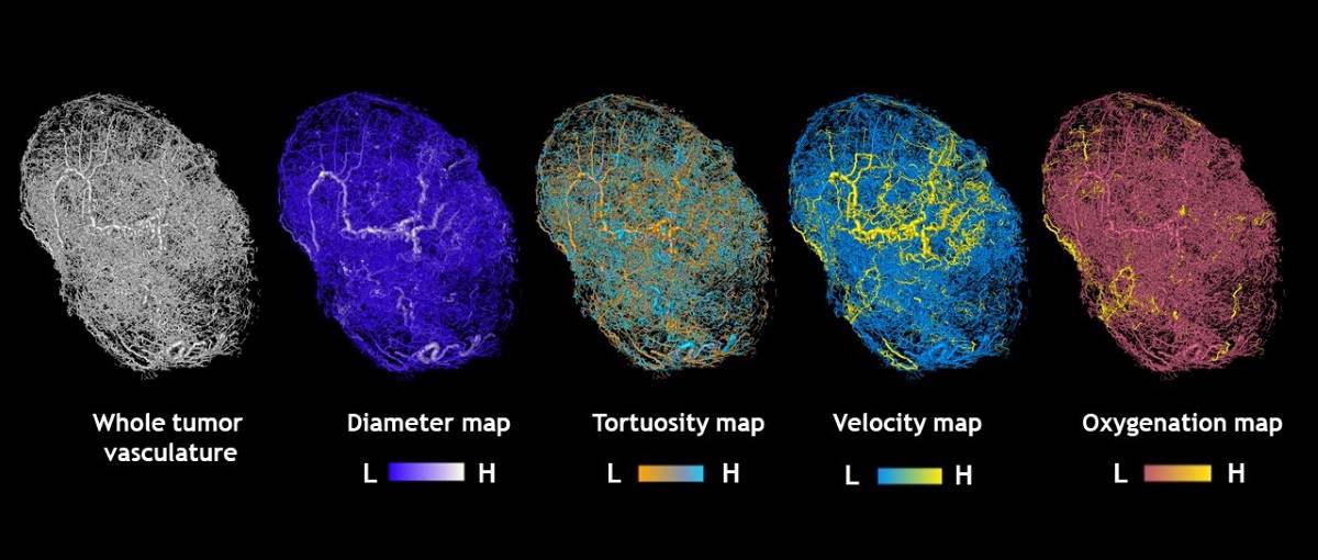 Tumour map