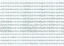 Electroencephalogram