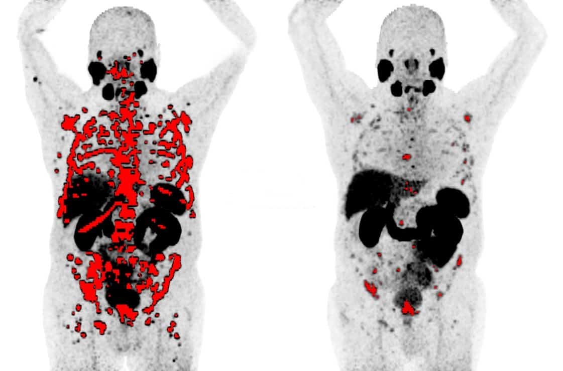 SNMMI Annual Meeting showcases nuclear medicine innovation Physics World