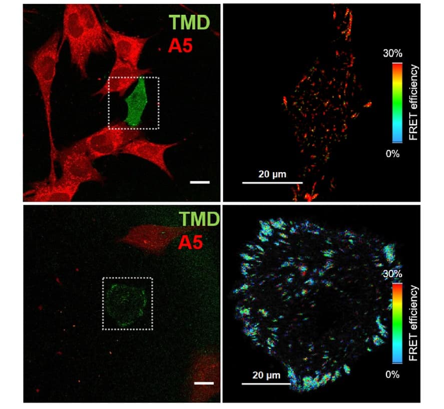 Cancer cell motion