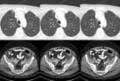 CT images