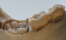 orangutan teeth