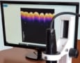 Virtual biopsy device