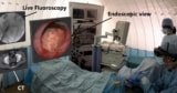 Augmented reality