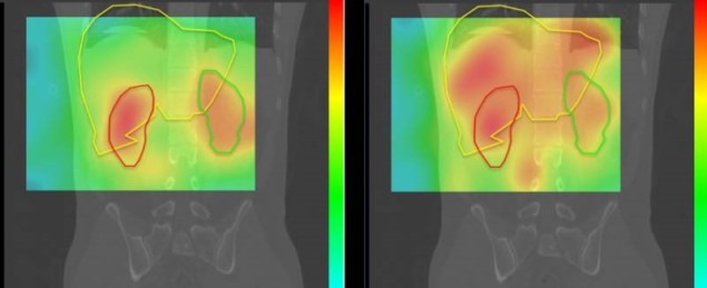 Simultaneous imaging