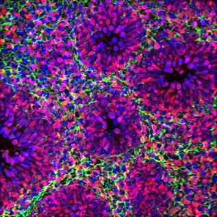 Brain organoid at one month