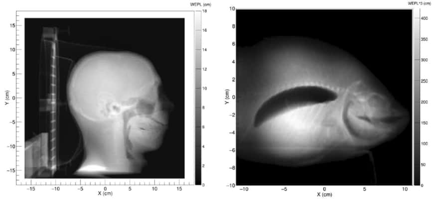 Proton imaging moves a step closer to the clinic – Physics World