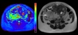 Assessing placental oxygenation