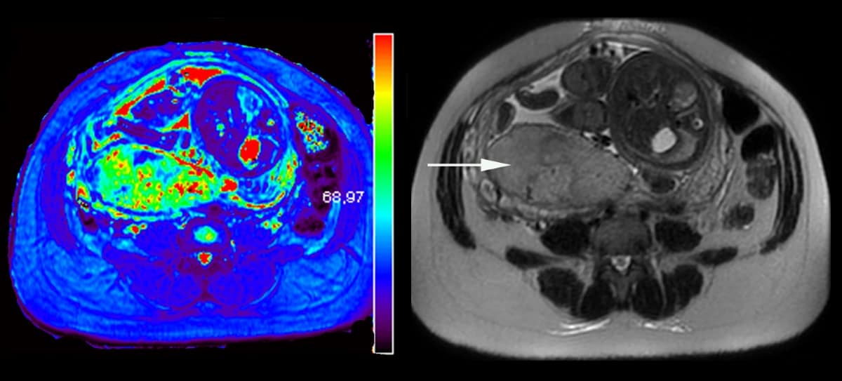 Assessing placental oxygenation