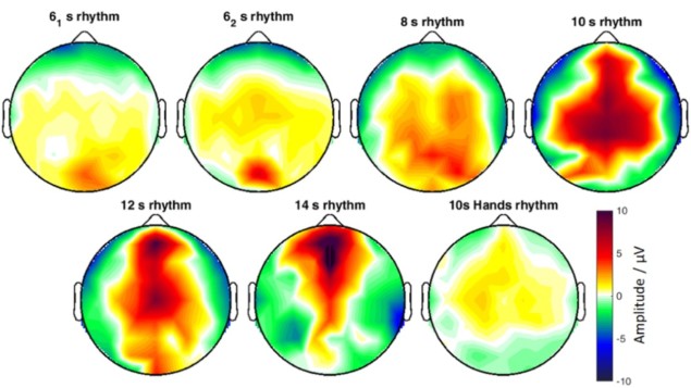 Slow cortical potentials