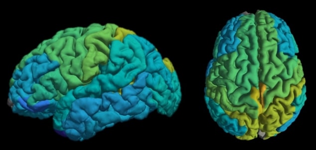 MRI brain map MRI brain map