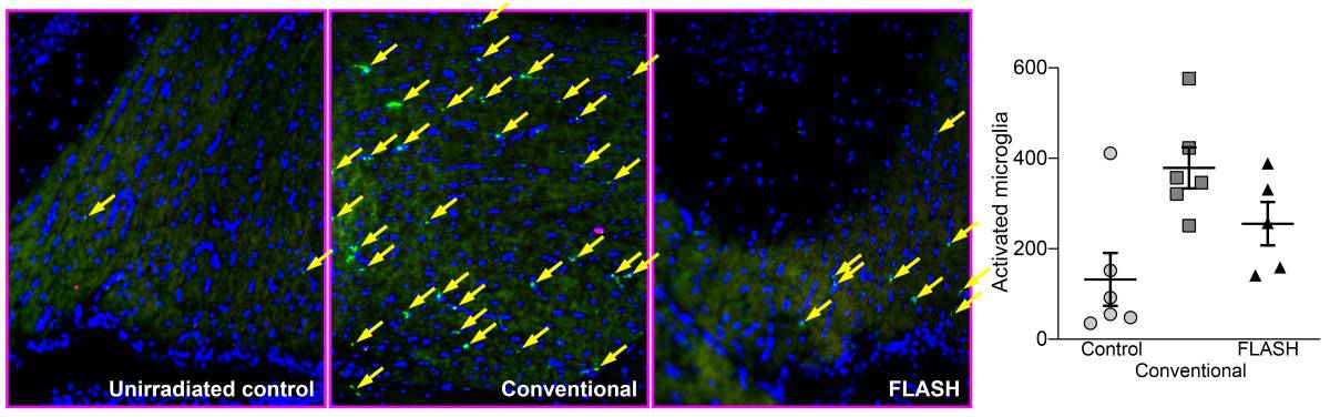 FLASH brain irradiation