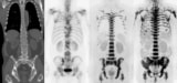 Multimodality imaging