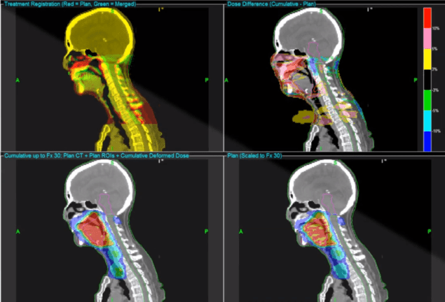 Adaptivo from Standard Imaging