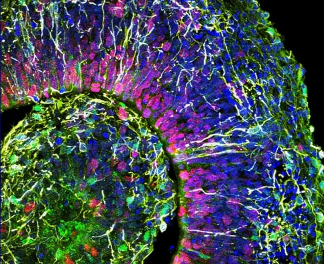 Organoid cross section