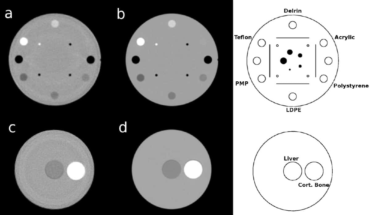 Proton Ct Or Dual Energy X Ray Ct Which Wins Out For Proton Planning Physics World