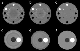 Proton CT or dual-energy X-ray CT: which wins out for proton planning ...